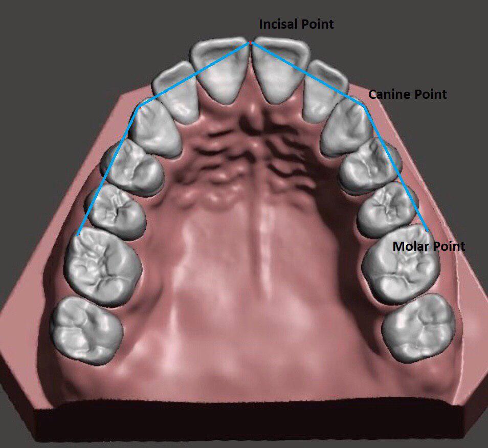 Developing a new method for prediction of dental arch perimeter QS GEN