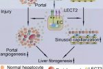 The mechanism by which LECT2 Tie1 signaling in liver endothelial cells promotes liver fibrogenesis