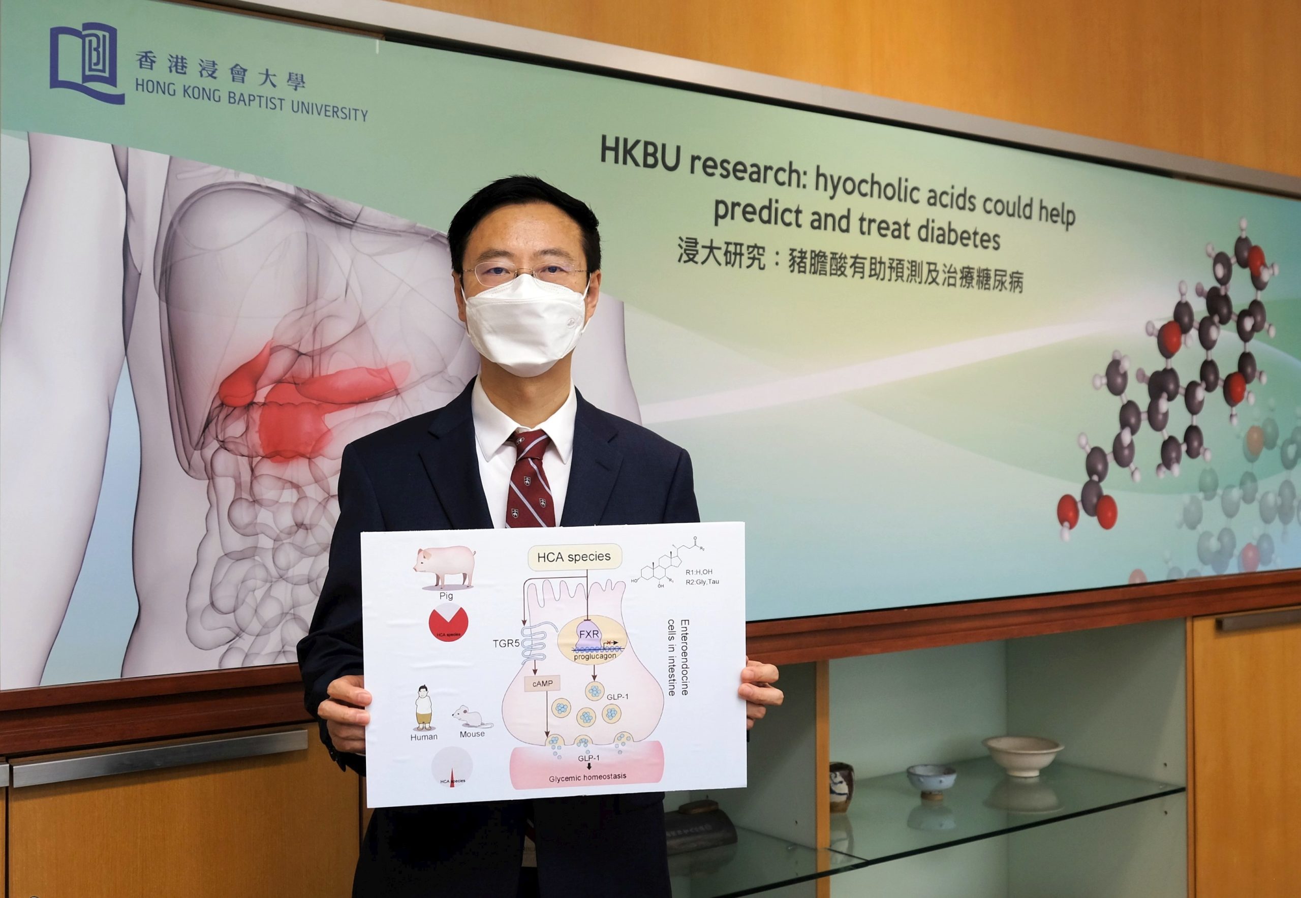 HKBU-led research reveals hyocholic acids are promising agents for diabetes prediction and treatment